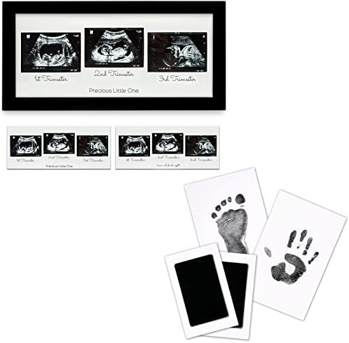 Комплект за рамки от тройната сонограммой KeaBabies Отпечатък Baby & Handprint Комплект Подложки за мастило без мастило