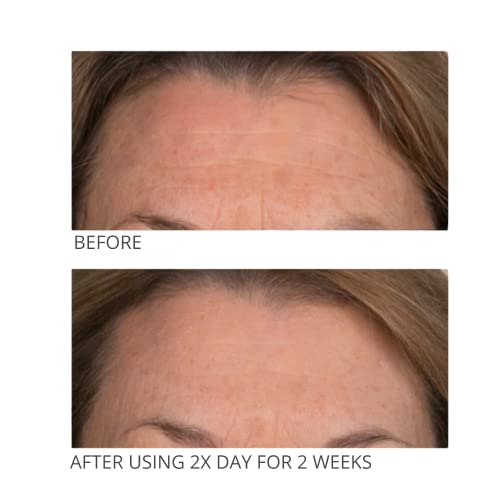 Сериозни грижи за кожата Serious-Подложки от ефира на витамин С – Стареене терапия за лице за по-сияйна и гладка кожа,