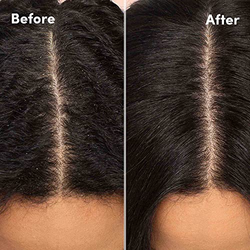 Набор от шампоани и балсами MIZANI Scalp Care от пърхот | Пиритион Цинк | Почиства Косата и скалпа | За Къдрава коса