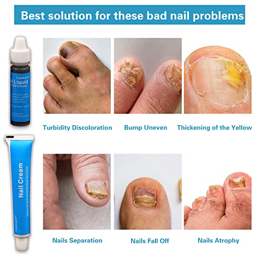 Lanmayee Nail Treatment Renewal Kit, Средство за възстановяване на ноктите на краката е Повишена здравина на ноктите на
